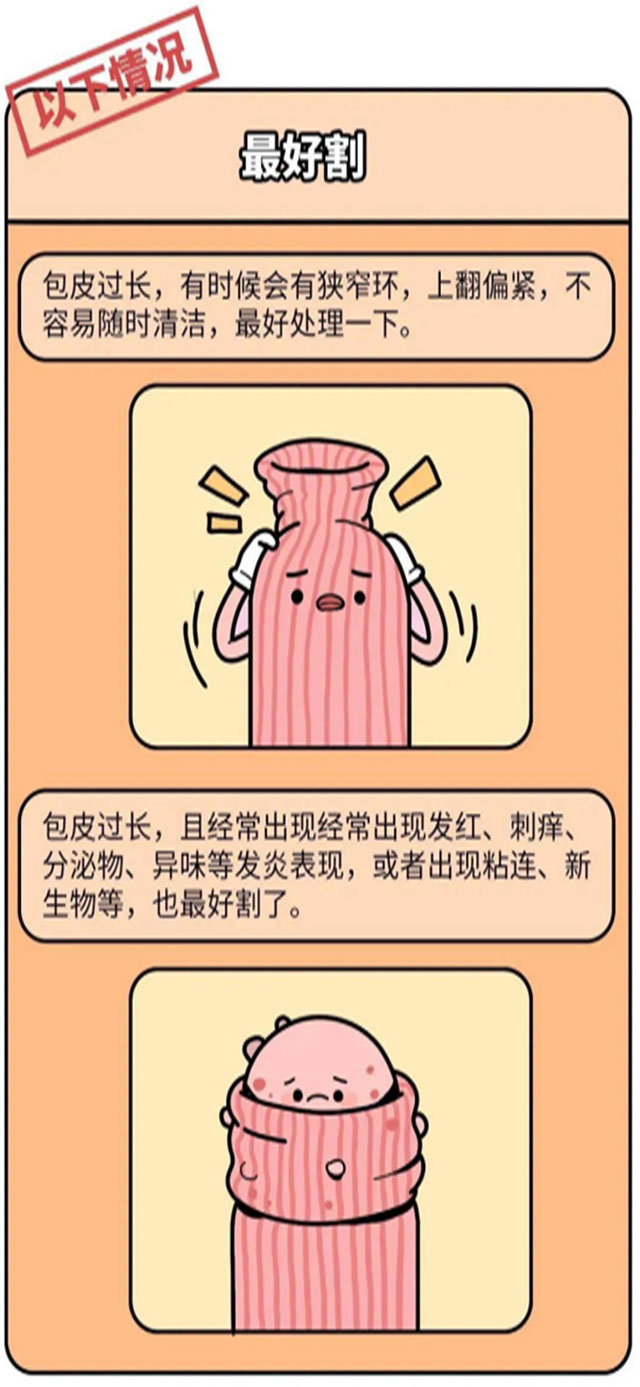 漫談小兒包皮