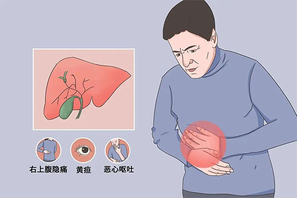 患有膽結(jié)石，不想切膽怎么辦？