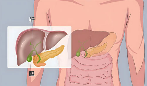 關(guān)注膽囊健康，共筑生命防線：膽囊占位，不容忽視的警訊