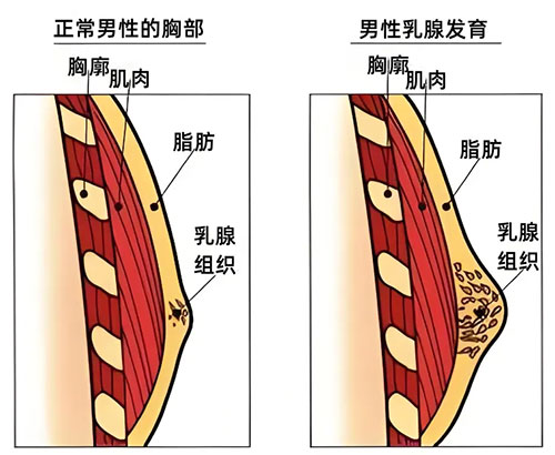 從“硬漢”到“奶爸”——乳腺健康不分性別，守護(hù)從了解開始