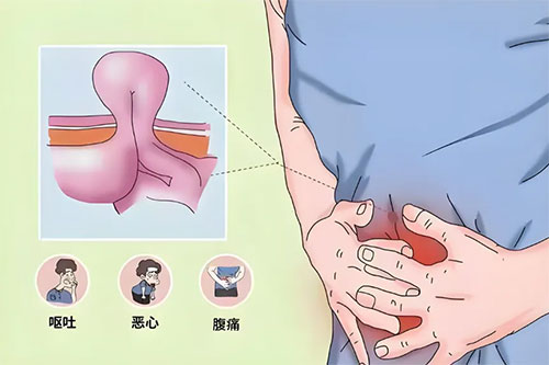 合肥中山外科醫(yī)院-久坐不動(dòng)，小心“疝氣”找上門(mén)——腹股溝疝
